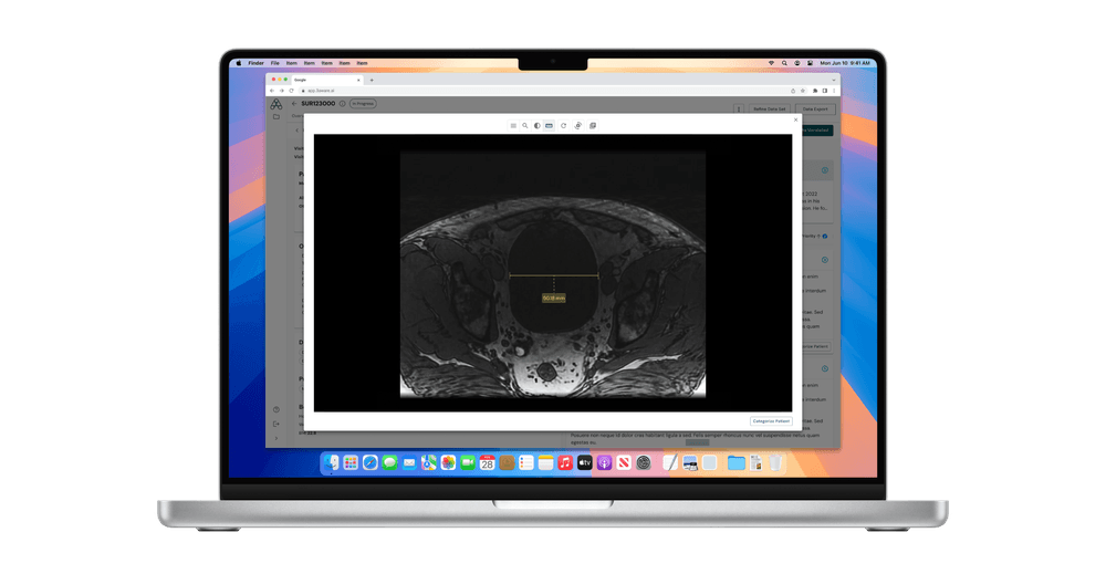 DICOM Viewer on Macbook